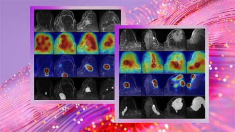 The image features a digital collage with two main elements. The first one shows two sets of mammogram scans, each with three rows and five columns. The top rows show grayscale images, the middle rows display heatmaps highlighting areas of interest, and the bottom rows present additional grayscale views. The second one in the background features an abstract design with pink and purple tones and light streaks