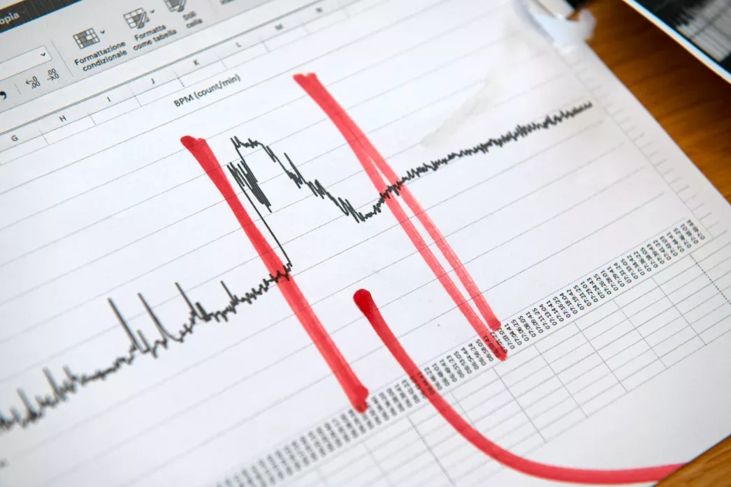 An ecg chart with a red line on it.